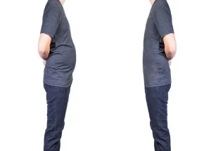 چرا بعد از لیپوماتیک شکم خطوط ناصافی زیر پوست دیده می‌شود؟