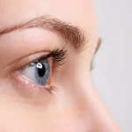 لیفت شقیقه در سنین پایین: حداقل سن و محدودیت ها