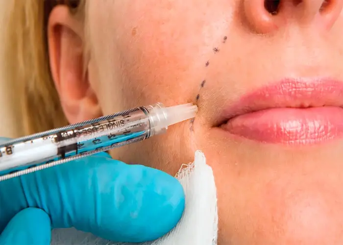 تفاوت تزریق چربی به تزریق ژل