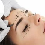 تفاوت لیفت شقیقه با لیفت ابرو: کدام روش مناسب‌ تر است؟