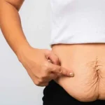 نقش پیکرتراشی بعد از بارداری