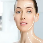 جوانسازی چهره با لیفت شقیقه