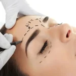 لیفت ابرو بدون درد