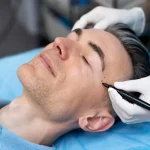 رابطه بین نوع ابرو و روش لیفت؛ چه فرمهایی نیازمند چه تکنیکی هستند؟