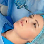 عوارض موقتی حس بی‌حسی بعد از لیفت شقیقه؟