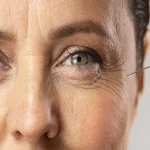 لیفت صورت در سن ۶۰ سال: چه انتظاری باید داشته باشید؟