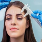 آیا لیفت شقیقه می‌تواند ظاهر چشمان‌تان را تغییر دهد؟