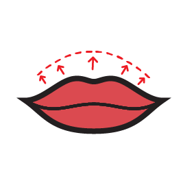 لیفت مستقیم لب بالا و پایین