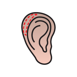 جراحی زیبایی لاله گوش