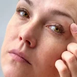 لیفت ابرو در واکنش به استرس