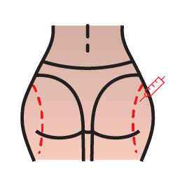 تزریق چربی به باسن