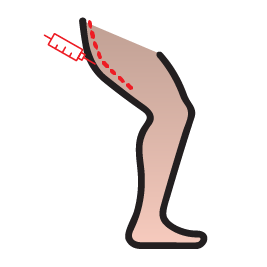 تزریق چربی به ران