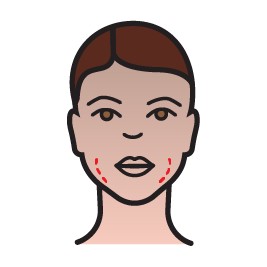 پروتز زاویه فک