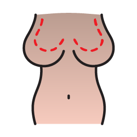 پروتزپکسی
