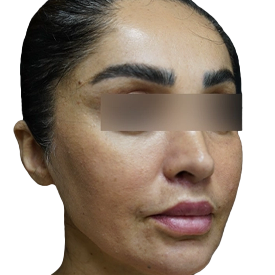 عمل سانترال لب