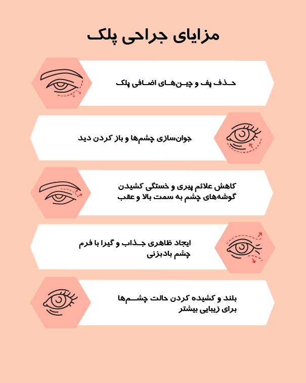 بلفارو