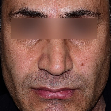 جراحی لب و دهان