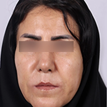 جراحی لب و دهان