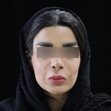 جراحی لب و دهان