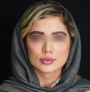 جراحی پلاستیک صورت