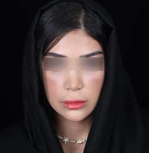 جراحی پلاستیک صورت
