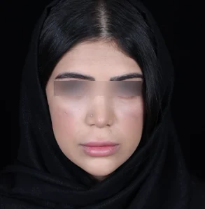 جراحی پلاستیک صورت