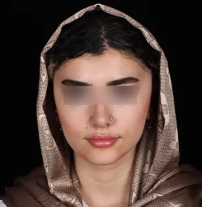 جراحی پلاستیک صورت