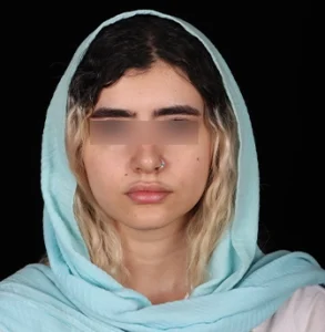جراحی پلاستیک صورت
