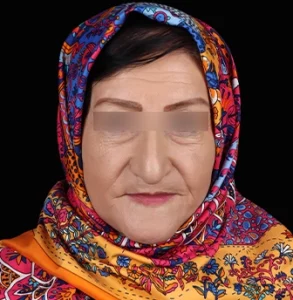 جراحی پلاستیک صورت