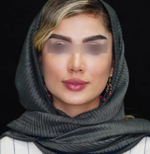 جراحی پلاستیک صورت
