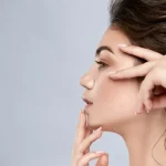 بعد از لیفت شقیقه، تورم و کبودی چند روز طول می‌کشد؟