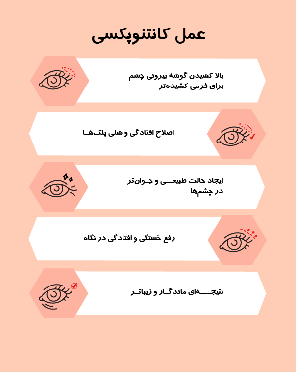 http://عمل%20کانتوپکسی