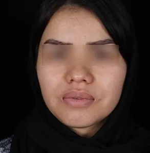 جراحی لب و دهان