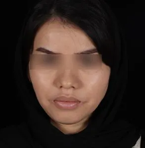 جراحی لب و دهان