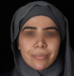 جراحی لب و دهان