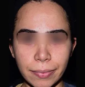 جراحی لب و دهان