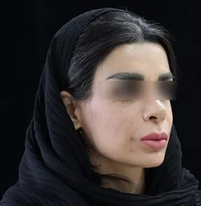 جراحی لب و دهان