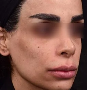 جراحی لب و دهان