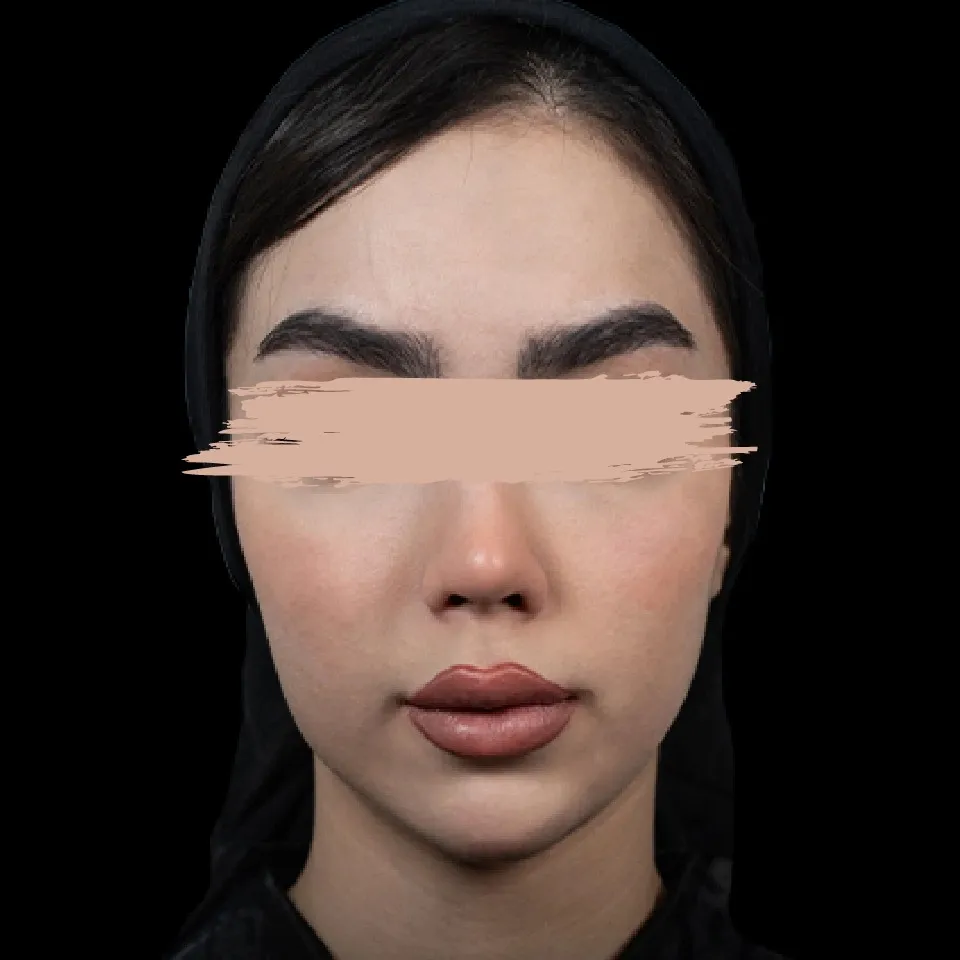 مادلینگ صورت