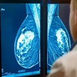 چگونه انتخاب پروتز سینه بر کیفیت ماموگرافی و چکاپ پستان تأثیر می‌گذارد