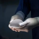 آنچه را که تا الان درباره ماموپلاستی افزایشی نمیدانستید!