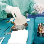 آیا ممکن است بعد از جراحی سینه تماس با فلزات یا شی سنگین مشکل‌ساز شود؟