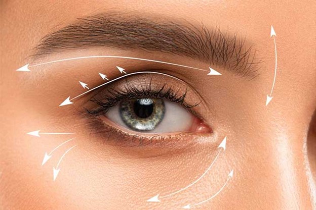 تأثیر بلفاروپلاستی پلک بالا بر دید و میدان بینایی؛ چه انتظاری داشته باشیم؟