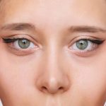 کانتوپلاستی و تناسب با فرم صورت: چه زاویه‌ای طبیعی و زیباست؟