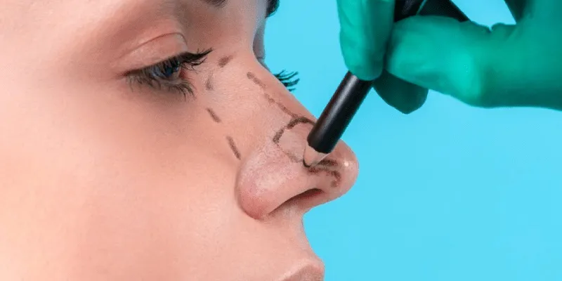 مراقبت بعد از جراحی بینی استخوانی