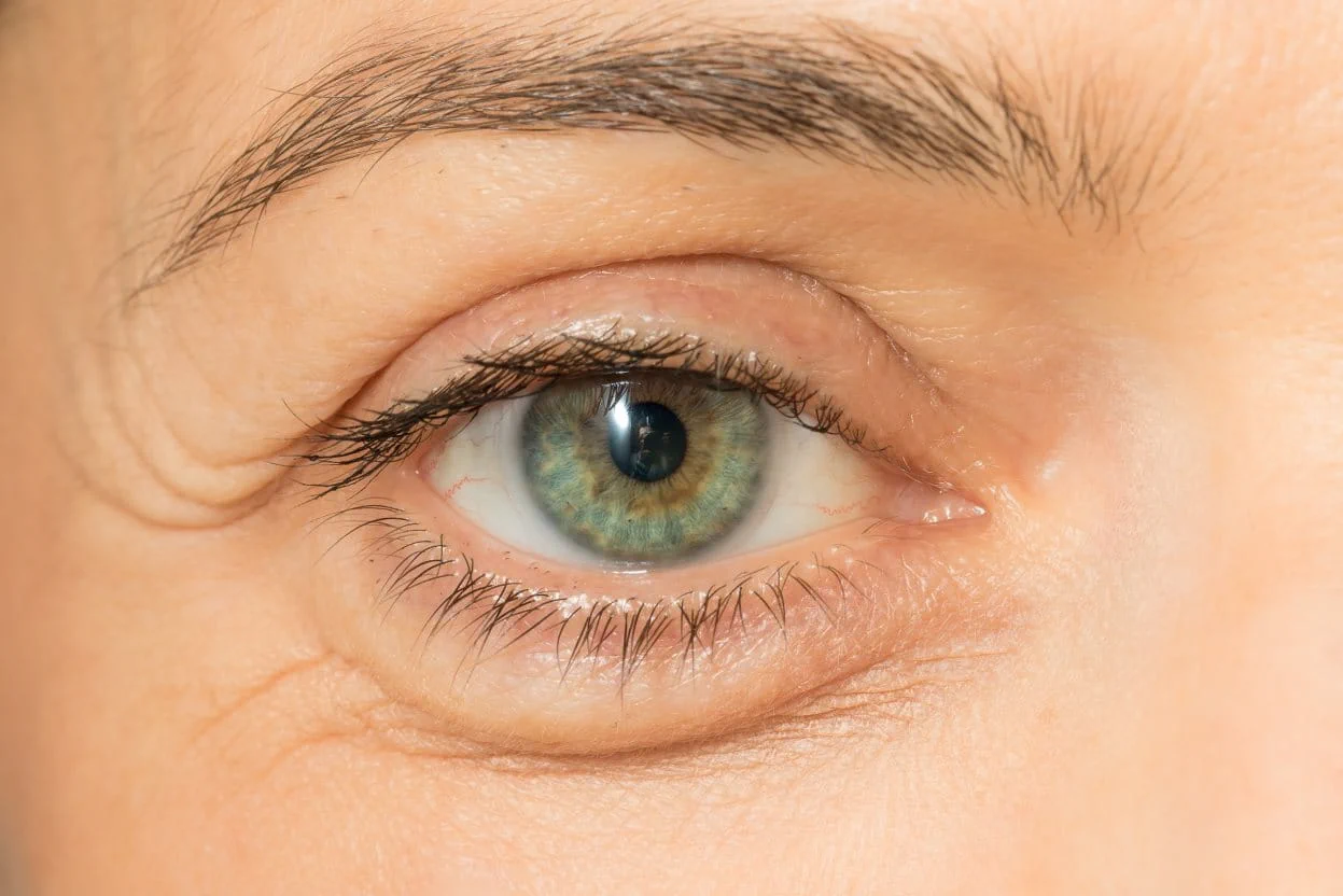 تکنیکهای مدرن کاهش پف پلک پایین و تفاوت نتایج با روشهای قدیمی