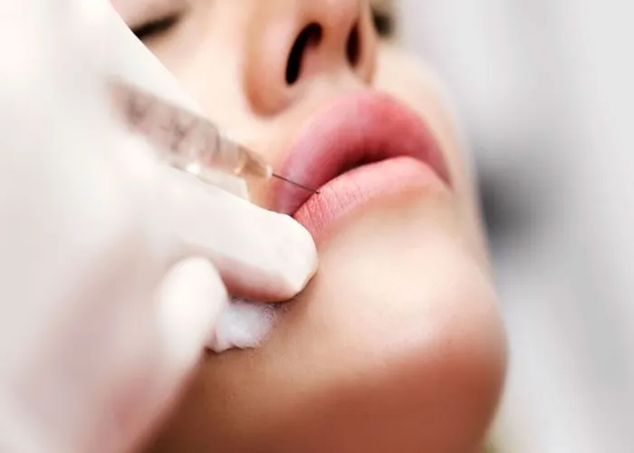 تغییر لبخند بعد از لیفت صورت