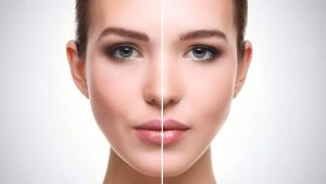 تفاوت جذب چربی در دو سمت صورت؛ چرا رخ می‌دهد؟