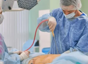 دلایل ایجاد ناهمواری پوست بعد از لیپوماتیک شکم