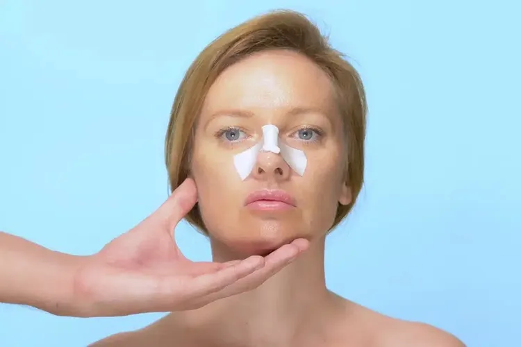 کنترل ورم بینی در جراحی بینی